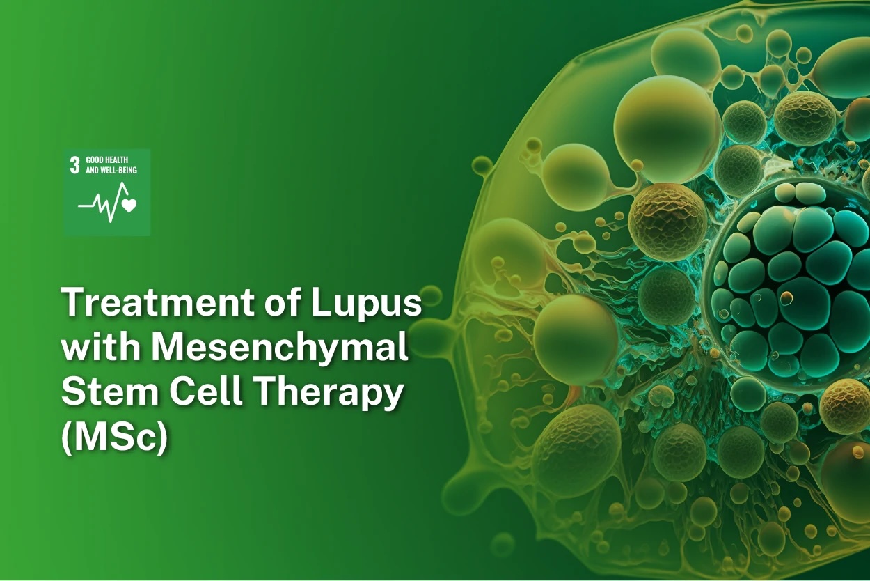 Liệu pháp tế bào gốc trung mô (MSC) trong điều trị Lupus Nephritis: Cơ chế và hiệu quả mới nhất 2025
