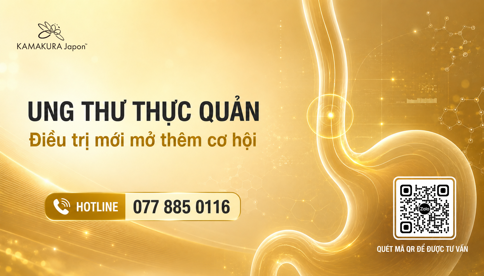 Ung thư thực quản: Các lựa chọn điều trị mới và khi nào nên cân nhắc điều trị ở nước ngoài