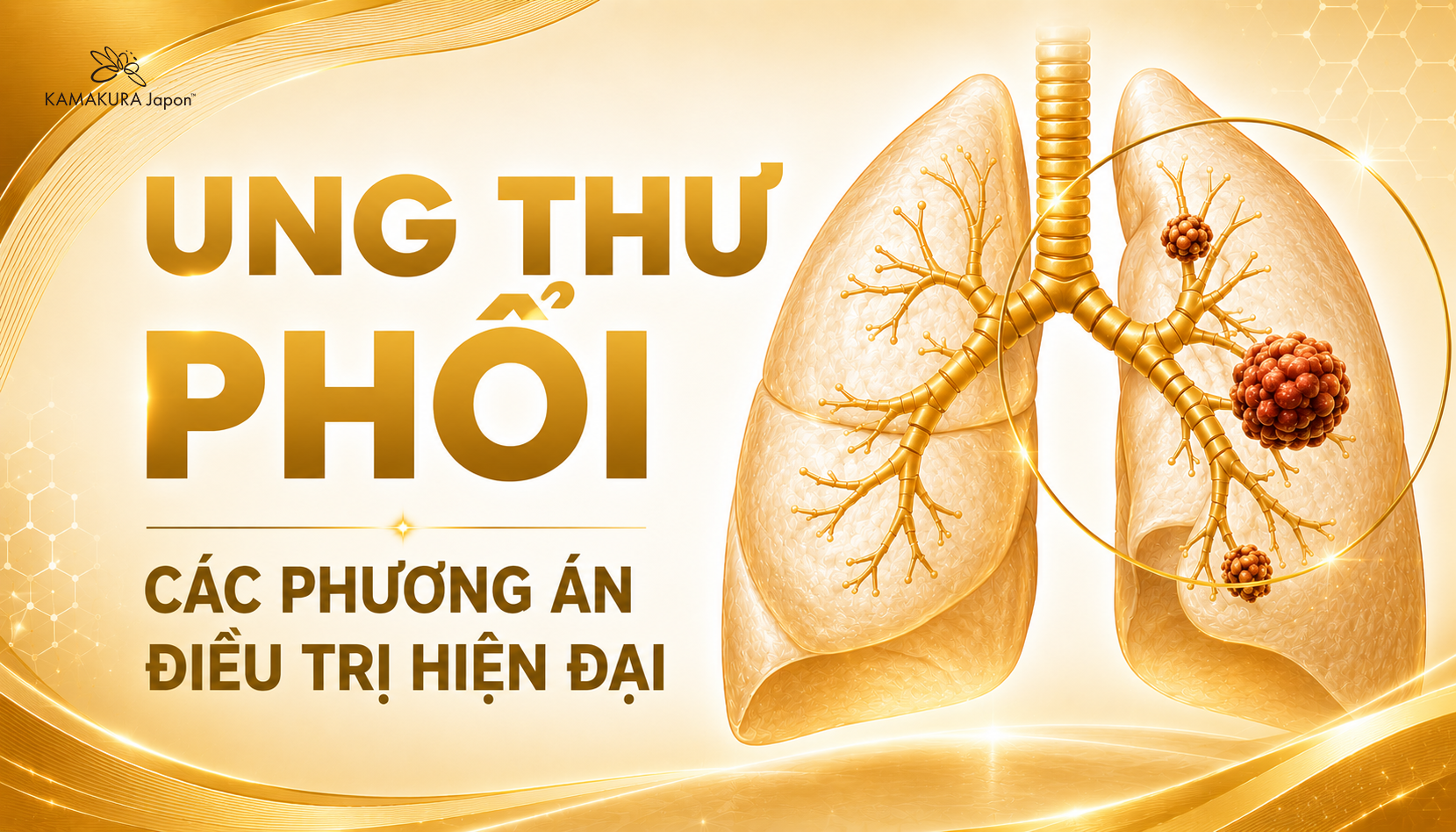 Ung Thư Phổi: Nguyên Nhân, Dấu Hiệu Nhận Biết Và Phương Pháp Điều Trị Mới Nhất