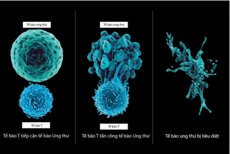 Liệu pháp miễn dịch tế bào/ Điều trị gen